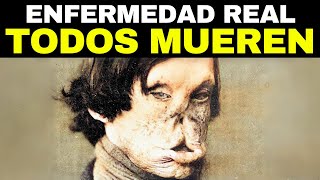 Las 12 Enfermedades Más Terribles De La Historia [upl. by Ahserak]