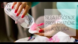 Kako da negujem lice Večernja nega i čišćenje problematične kože lica [upl. by Bernadine976]