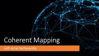 Coherent Mapping left atrial tachycardia after previous AF ablation [upl. by Ailedamla293]