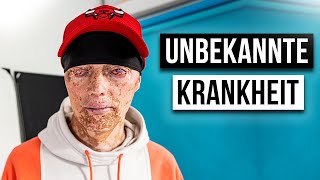 Wie ist das EINE UNBEKANNTE KRANKHEIT ZU HABEN [upl. by Niwred]