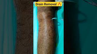 Drain Removal From Leg💥 [upl. by Rotman]