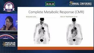 PSNM 2024  PETCT Imaging in Hematological Malignancies  Riffat Hussain [upl. by Silver]