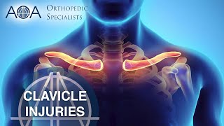 AOA Orthopedic Specialists  Clavicle Injuries [upl. by Qidas]