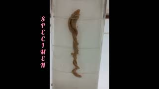 Balanoglossus 🪱  Hemichordata  NonChordata  Specimen [upl. by Bega]