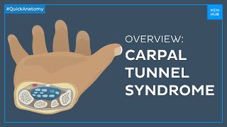 Carpal tunnel syndrome Symptoms causes treatment  Quick Anatomy  Kenhub [upl. by Alis]