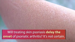 Psoriatic arthritis eludes early diagnosis [upl. by Esinehc]