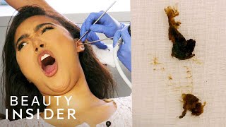 How Earwax Is Professionally Extracted  Beauty Explorers  Insider Beauty [upl. by Akeim]