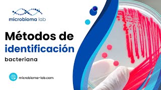 🦠🧫 ¿Qué TÉCNICAS existen para IDENTIFICAR BACTERIAS 🦠🧫 [upl. by Stickney]