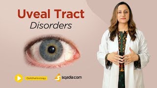 Uveal Tract Disorders  Ophthalmology Video Lecture  Medical Education  VLearning [upl. by Brubaker353]