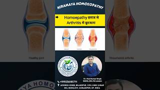 arthritis गठिया homeopathic treatment permanent live short shortvideo youtube viral ilaj [upl. by Chuipek]