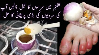 CHILBLAINS Treatment  Home Remedy For Swollen Fingers During Winter [upl. by Aicinod]