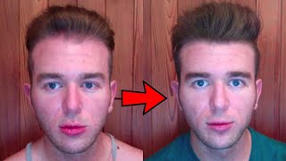 My Current Hair Loss Prevention Regimen [upl. by Seve]