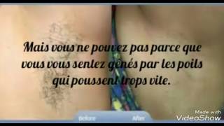 3 techniques pour se débarrasser définitivement des poils😀😀😀😀✴✴✴✴✴ [upl. by Aihsenek65]