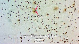 Peritrichous flagella under the microscope [upl. by Sherlocke]