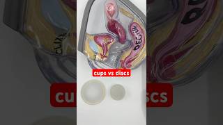 Menstrual Cups vs Menstrual Discs  quick overview shorts [upl. by Allegna758]