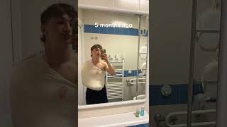 5 months body transformation Injury comeback motivation bodybuilding injury [upl. by Irod617]