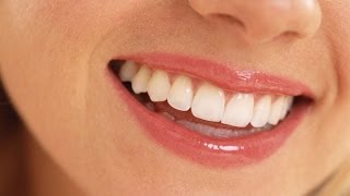 Reversing Tooth Decay by using electrical currents No Drilling and No Fillings [upl. by Olecram]