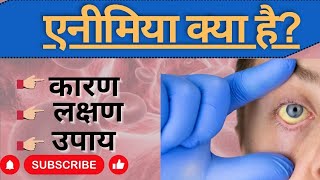 एनीमियाखून की कमी क्या होती है।Anaemia in hindi।Information about anaemia। रक्ताल्पता का अर्थ।। [upl. by Leirbaj]