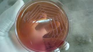 Morgenella morganii Colony Morphology on Macconkey Agar Demonstration [upl. by Genesa97]