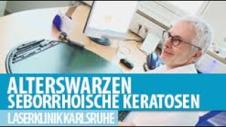 Seborrhoische Keratosen Alterswarzen [upl. by Mag]