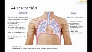 Exámen Físico Pulmonar [upl. by Chancelor]