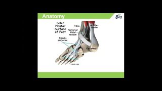 Tibialis Posterior Dysfunction Anatomy Causes amp Management [upl. by Adnaluy]