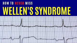 How to never miss Wellens syndrome [upl. by Brynna]