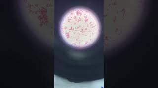 Bạn có biết trực khuẩn gram âm trông như thế nào dưới kính hiển vi không microscope shortvideo [upl. by Margie683]