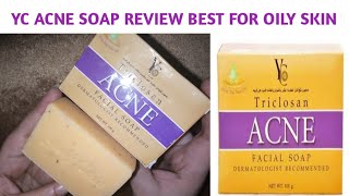 YC Acne triclosan soap review  Facial soap [upl. by Ynohtnaeoj530]