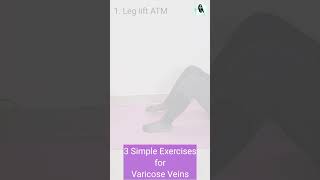 Varicose veins exercises varicoseveintreatment [upl. by Binny]