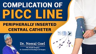 Understanding Complications and Management of Peripherally Inserted Central Catheters PICC line [upl. by Leeke]