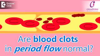 Why does menstrual bleeding have blood clots Is it normalDrShalini Varma of Cloudnine Hospitals [upl. by Ardnauq]