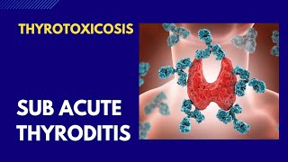 Thyrotoxicosis  Thyroiditis [upl. by Ahsetan]