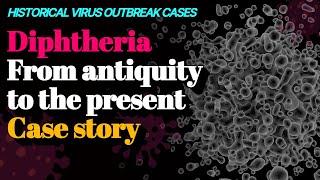 Diphtheria From antiquity to the present Case story 🦠Historical virus outbreak cases [upl. by Amoritta]