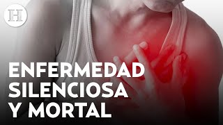 ¡Embolias e infartos Hipertensión arterial una enfermedad silenciosa causas y factores de riesgo [upl. by Yadnil]