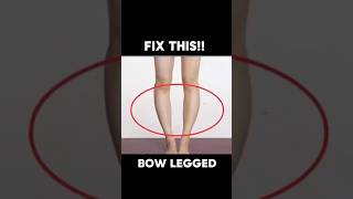 Bow Legged Exercises ✅bow bowlegged bowlegs legs shorts [upl. by Nehr]