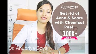 Chemical Peel for Acne Scar and Microneedling Skin Peeling Treatment [upl. by Loggins679]