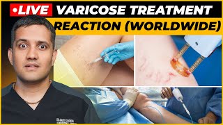 My Reaction on Venaseal Sclerotherapy amp Laser Treatment for varicose veins  Dr Gaurav G IR [upl. by Primalia]