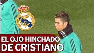 Cristiano apareció con le ojo bastante hinchado  Diario AS [upl. by Sublett]