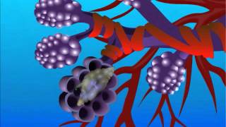 Aspergillosis – Type of Fungal Infection [upl. by Ydal776]