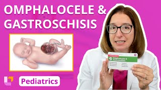 Omphalocele amp Gastroschisis  Pediatric Nursing  LevelUpRN [upl. by Lilithe]