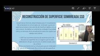 Tomógrafo Tipos de reconstrucciónes [upl. by Noman]