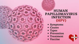 Human papillomavirus infection  HPV  What is HPV amp How do you get it [upl. by Kirbie]