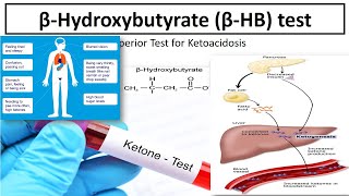 Acyalation of ethyl acetoacetate with acetyl chloride [upl. by Dorfman785]