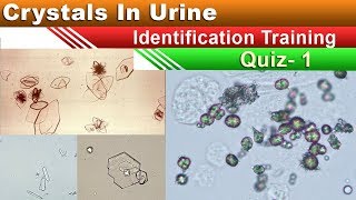 Crystals In Urine Identification Training Quiz  Part 15 [upl. by Lladnek]