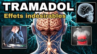 TRAMADOL et ses EFFETS INDESIRABLES à connaître [upl. by Kirre]