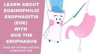 Learn about Eosinophilic Esophagitis EoE with Gus the Esophagus [upl. by Sardse898]