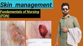 Skin management   pressure ulcer [upl. by Ameluz622]