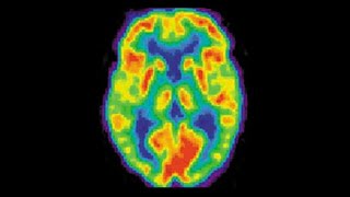 Det biologiska perspektivet  neuropsykologi [upl. by Dill]