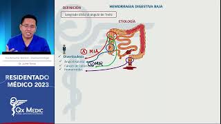 Gastroenterología  5 Hemorragia Digestiva Baja [upl. by Aicemak]